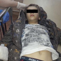 Мессенджер-истерия с поисками родителей «мальчика без сознания» затронула и Лобню