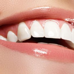 Столичные врачи описали наиболее безопасные способы отбеливания зубов